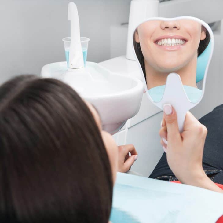 dental veneers in North Naples