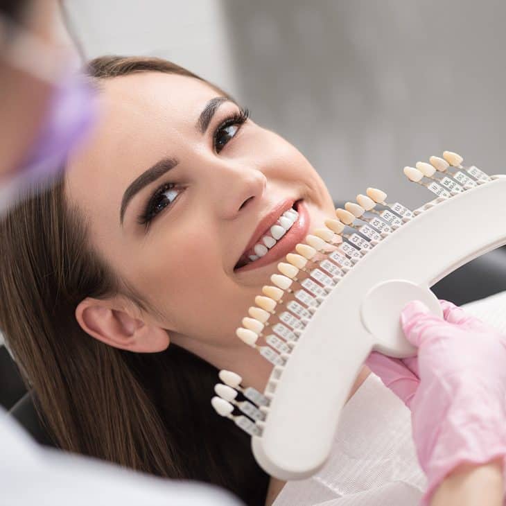 porcelain veneers in North Naples, FL