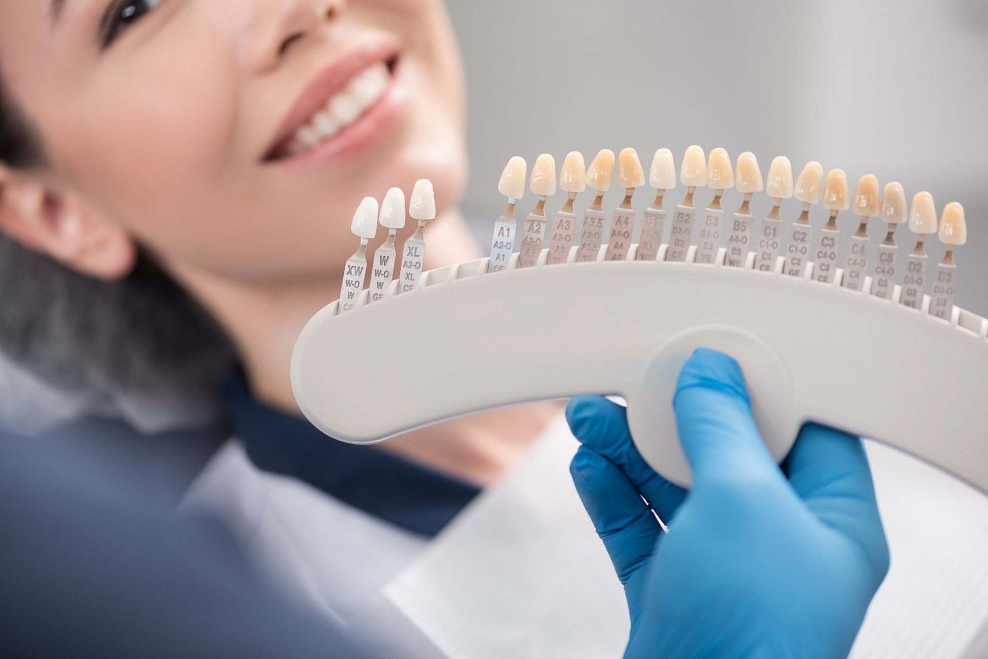 how-can-i-whiten-my-teeth