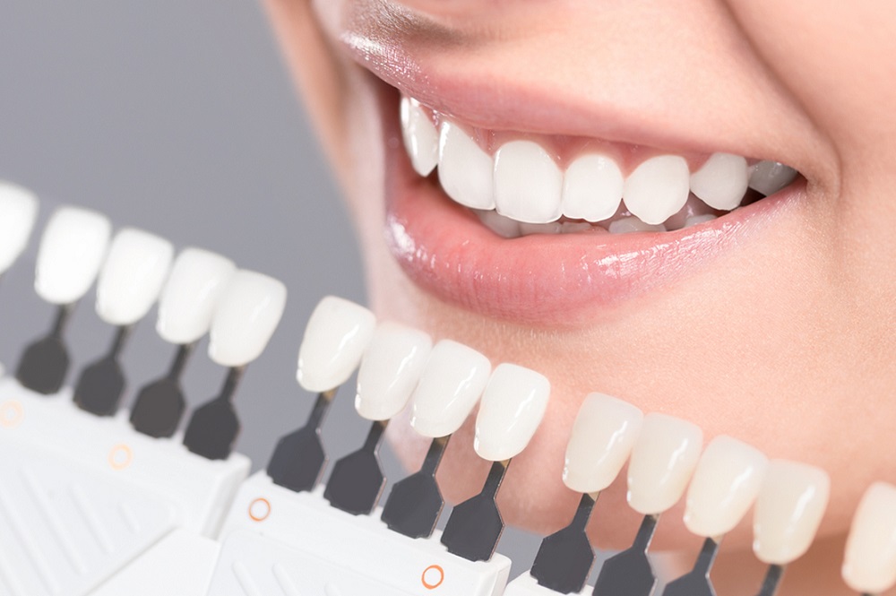 what is the difference between porcelain veneers and composite veneers