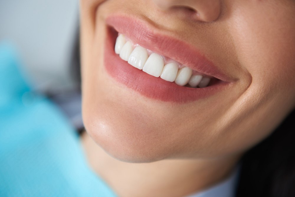 some things to know about zoom teeth whitening