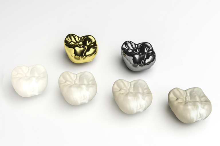 Everything You Need to Know About Porcelain Restorations