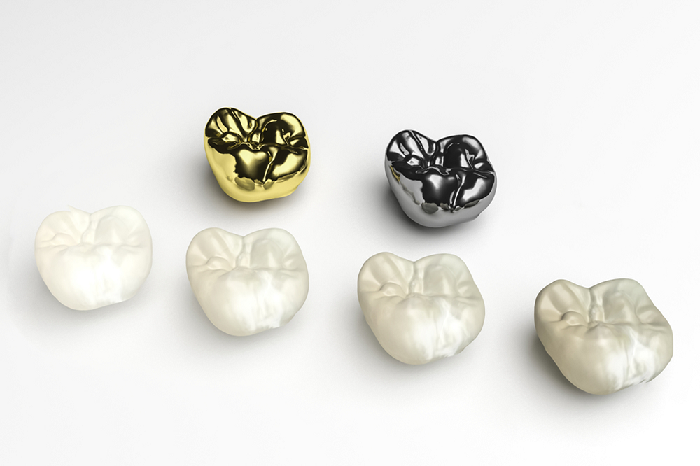 porcelain restorations