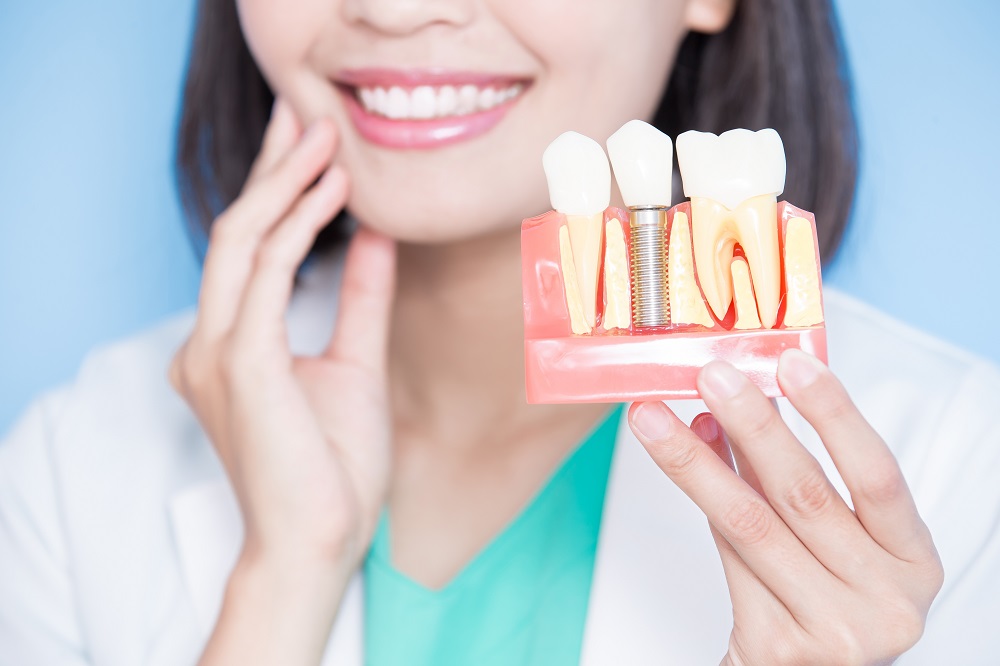 dentist explaining about dental implants
