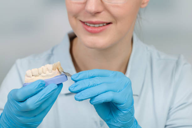 how long does a dental bridge last lifespan care tips