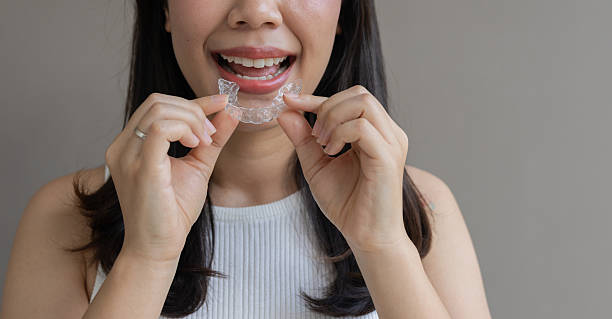 how invisalign improves your smile and confidence